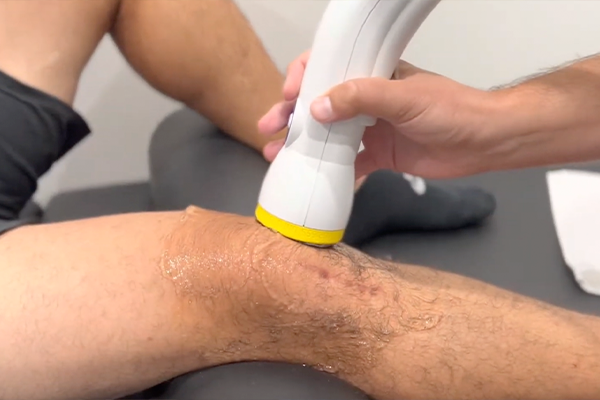Knee Pain and SoftWave Therapy: A New Era in Conservative Pain Management